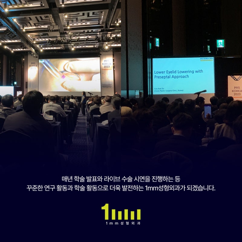 1mm جراحة التجميل: المدير الطبي دو أون روك يجري عملية جراحية مباشرة في PRS KOREA، صورة 3