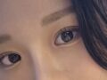 Bedah Plastik Ilmiri, adhesi alami + operasi kedutan perut, saya terima dari Dr. Do Eon-rok.