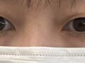 ดร. ฮงจิน คิม จากคลินิกศัลยกรรมตกแต่งอิลมิริ การยึดเกาะตามธรรมชาติ