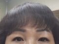 切開後期です
