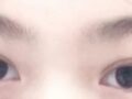 รีวิวการแก้ไขเปลือกตาแบบไม่ผ่าตัดของ ดร.คิม ฮงจิน