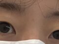 ドアンロック院長