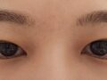 บทวิจารณ์ภาพยนตร์ Incisional Double Eyelid Surgery ของผู้กำกับโด