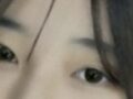 สองเดือนครึ่งหลังจากการตรวจติดตามผลการผ่าตัดแก้ไขดวงตาของ ดร.โด ออน-ร็อก