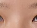 ผู้กำกับคิม ฮงจิน ศัลยกรรมตกแต่งเปลือกตา