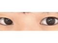 รีวิวการผ่าตัดทำตาสองชั้นแบบไม่ต้องกรีดของ ดร.คิม ฮงจิน