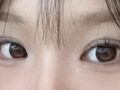 การผ่าตัดตกแต่งหัวตา, การยกเปลือกตาบน, การผ่าตัดสร้างเปลือกตาสองชั้นแบบไม่กรีด