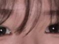 ศัลยกรรมตาสองชั้นของครูอิลมิริ โด ออน-ร็อก