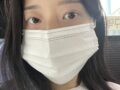 รีวิวการผ่าตัดแก้ไขสายตา