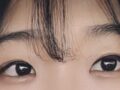 รีวิวการยกกระชับเปลือกตาบนด้วยวิธี Natural Adhesion โดย ดร.โด ออน-ร็อก หลังใช้ไป 3 เดือน