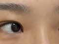 การตรวจสอบการผ่าตัดแก้ไขโดยผู้อำนวยการโด ออน-ร็อก