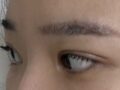 การผ่าตัดทำตาสองชั้นครั้งที่ 4... ถึง ผู้กำกับ โด ออน-ร็อก