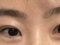 นี่คือบทวิจารณ์การผ่าตัดแก้ไขโดยผู้กำกับโด ออน-รก