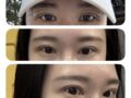 ฉันเข้ารับการผ่าตัดแก้ไขแผลผ่าตัดโดยผู้กำกับโด ออน-รก