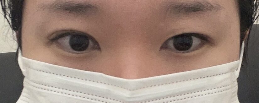 ฉันเข้ารับการผ่าตัดโดยผู้กำกับคิม ฮงจิน