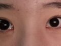 นายแพทย์โด ผู้เชี่ยวชาญด้านศัลยกรรมตา