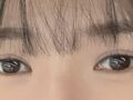การผ่าตัดแก้ไขเปลือกตาของผู้กำกับโด ออน-รก