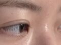 1毫米自然粘合 + 上眼睑提升