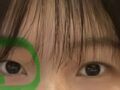 นายแพทย์คิม ฮงจิน จากคลินิกศัลยกรรมแก้ไขสายตาอิลมิริ