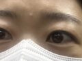 眉毛藻術+自然癒着レビュー