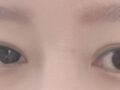 ผู้กำกับโด ออน-ร็อก แห่งอิลมิริ คือผู้เชี่ยวชาญด้านการแก้ไขรูปทรงดวงตาที่ดีที่สุด