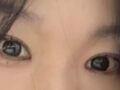 การผ่าตัดแก้ไขเปลือกตา, การกรีดเปลือกตา, การผ่าตัดตกแต่งหัวตา, ศัลยกรรมเปลือกตาบน โดยผู้กำกับ โด ออน-ร็อก