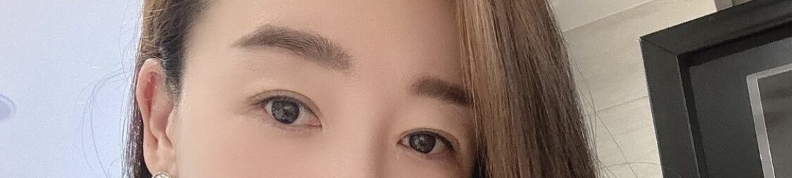 รีวิวหลังการผ่าตัดแก้ไขหนังตาสองชั้น 1 เดือน
