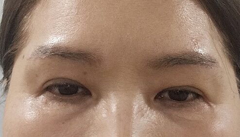 รีวิวการยกคิ้ว