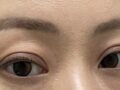 Đạo diễn Do Eon-rok thực hiện phẫu thuật khâu vết thương (Phẫu thuật chỉnh sửa).