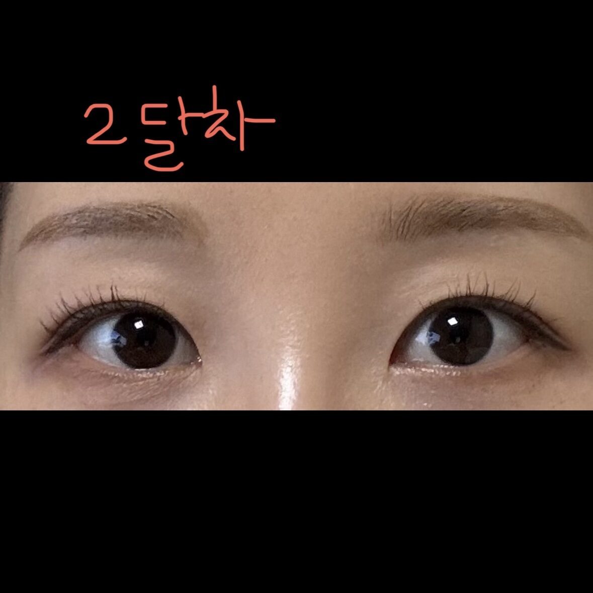 Câu chuyện thành công về khả năng kết dính tự nhiên của Tiến sĩ Kim Hong-jin