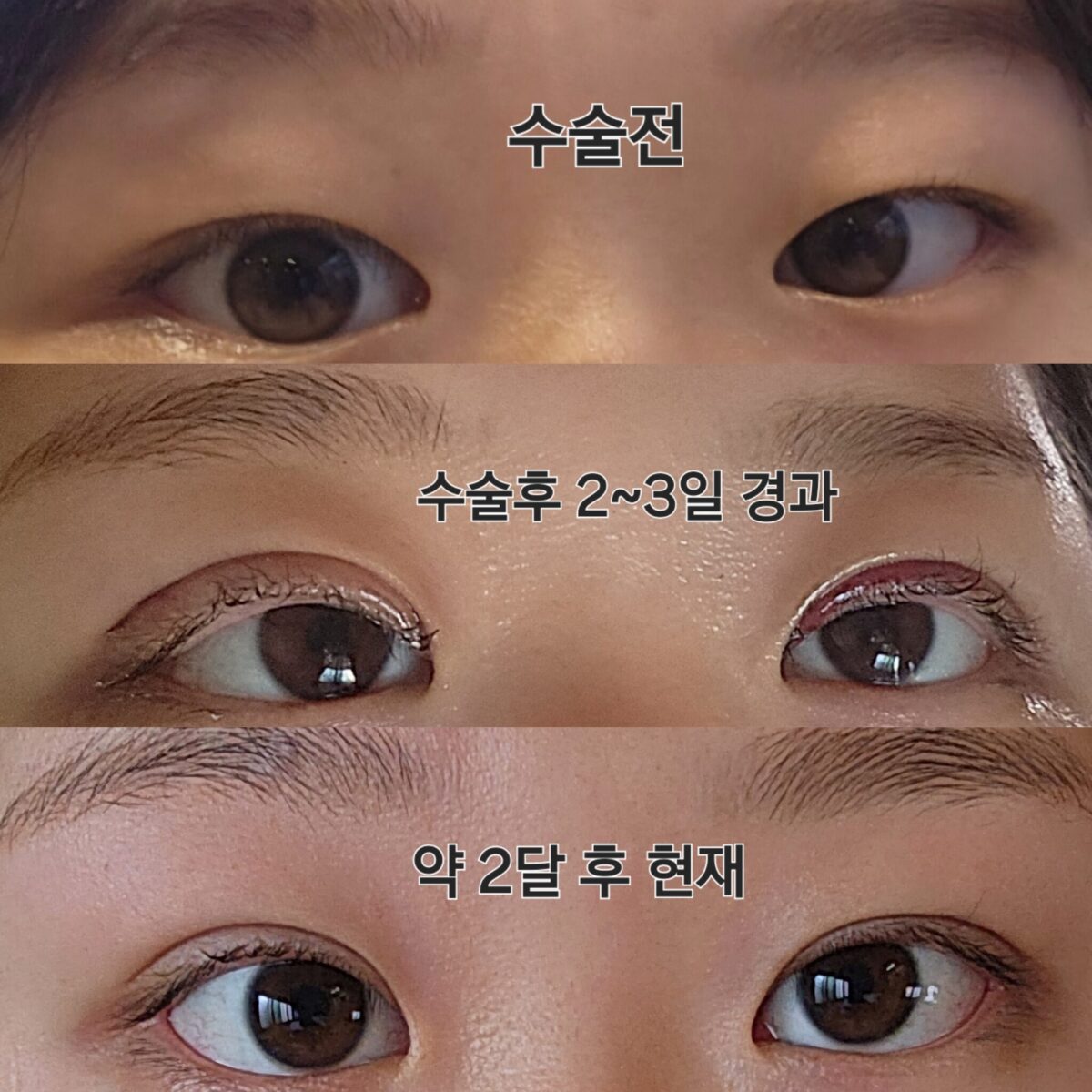 キム・ホンジン院長の自然癒着ウィットレビュー