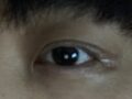 รีวิวการผ่าตัดของดร.โด