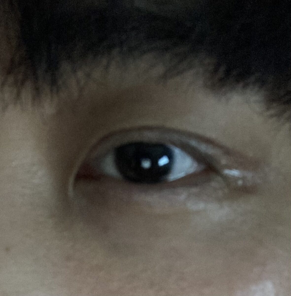 รีวิวการผ่าตัดของดร.โด