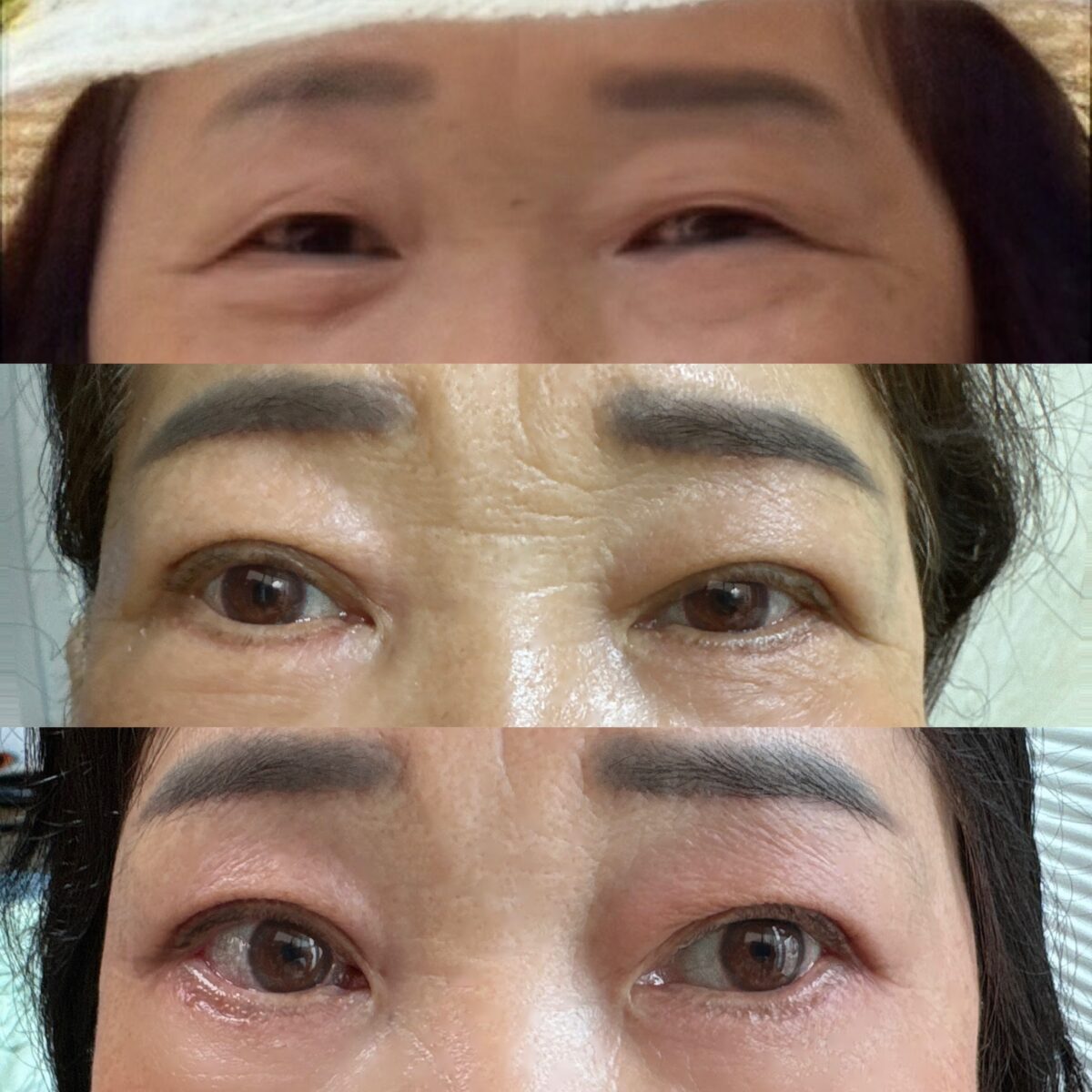 キム・ホンジン院長ペアカップル（中年成型）レビュー