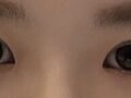 การผ่าตัดแก้ไขสายตาของผู้อำนวยการโด