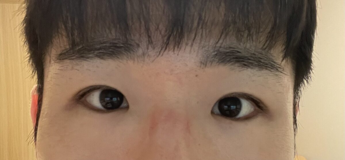 ศัลยกรรมตาชายของผู้อำนวยการใหญ่ โด ออน-ร็อก