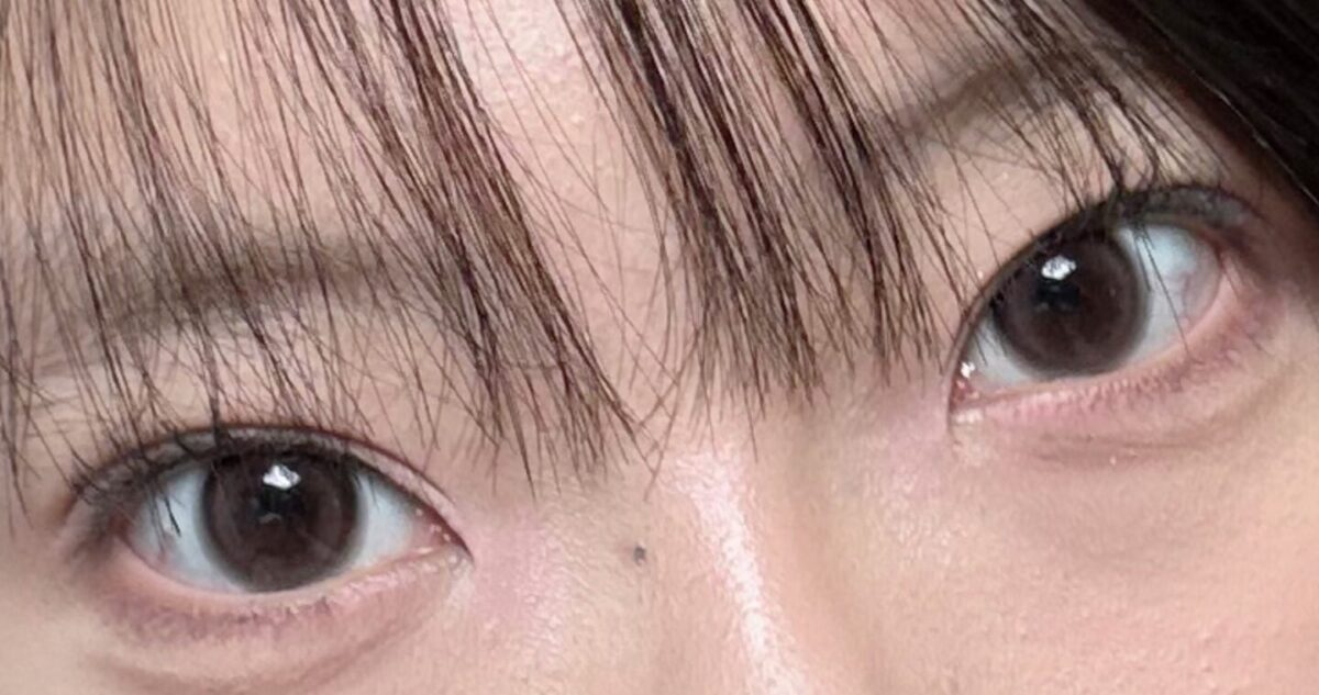 รีวิวการใช้ผลิตภัณฑ์ Natural Adhesion ของ ดร.คิม ฮงจิน หลังใช้ 2 สัปดาห์!