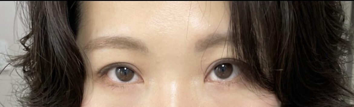 道言録院長初手術レビュー