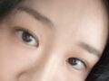 ผู้กำกับโด ออน-ร็อก - ศัลยกรรมแก้ไขสายตา