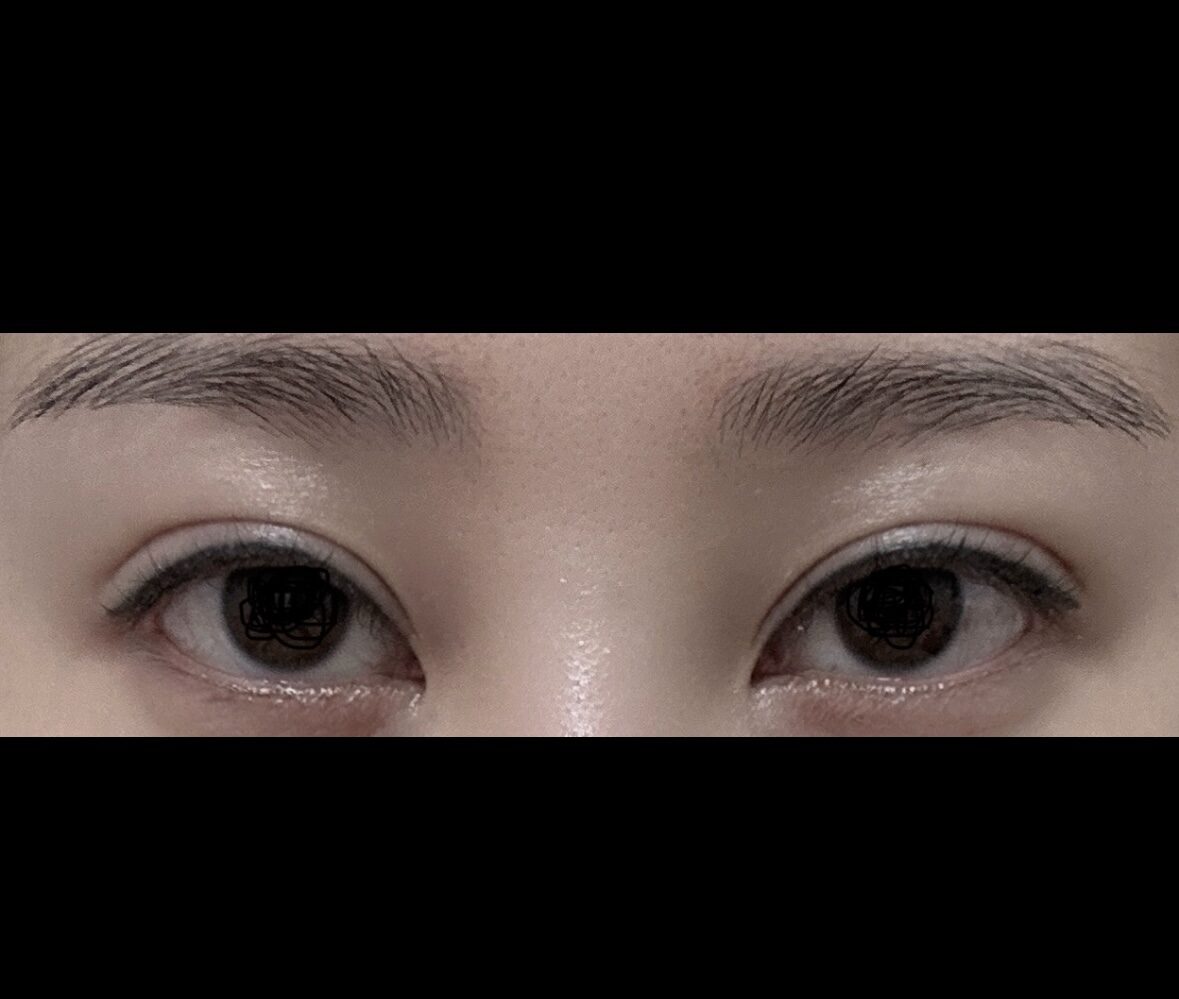 การทบทวนผลการสอบซ้ำหลังการผ่าตัด