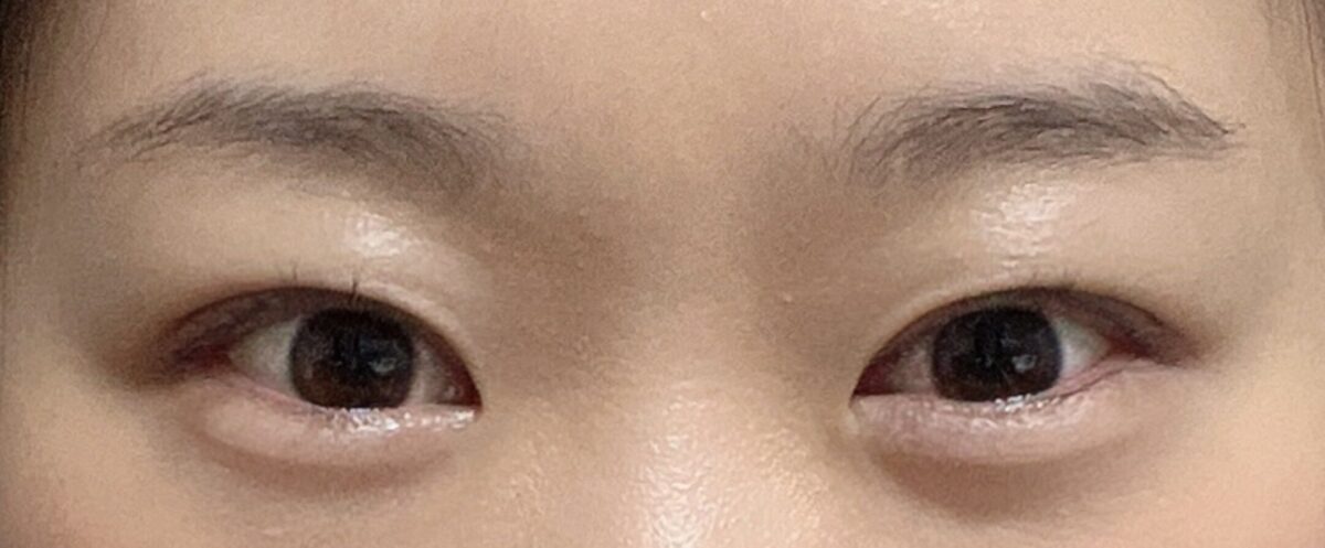 รีวิวการผ่าตัดของ ดร. นา ยองซู
