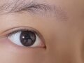 รีวิวการผ่าตัดทำตาสองชั้นแบบไม่ต้องกรีดของ ดร. คิม ฮงจิน ที่คลินิกอิลมิริ