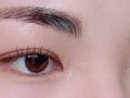 การผ่าตัดตา