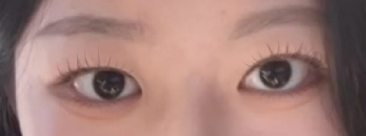 การผ่าตัดทำตาสองชั้นของผู้กำกับคิม ฮงจิน