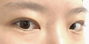 บทวิจารณ์ภาพยนตร์ผ่าตัดของผู้กำกับโด ออน-ร็อก แห่งอิลมิริ