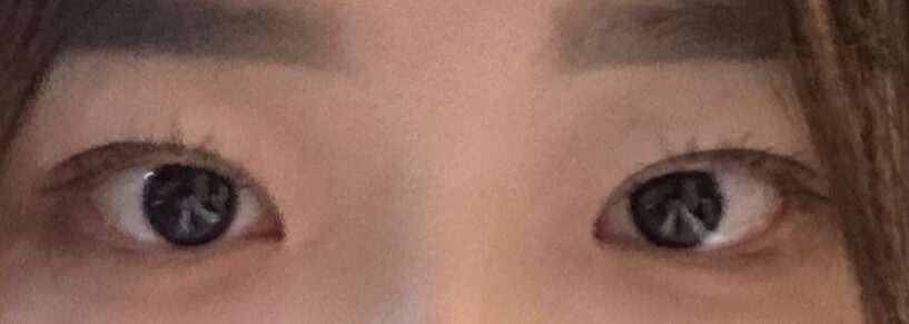 ดร. คิม ฮงจิน จากคลินิก Ilmiri Double Eyelid Buried Suture