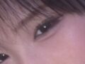 นายแพทย์ชอย บงกยู จากคลินิกศัลยกรรมพลาสติกอิลมิริ + การยึดติดตามธรรมชาติ สำหรับการผ่าตัดทำตาสองชั้น