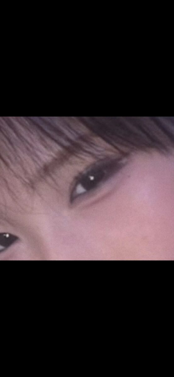 นายแพทย์ชอย บงกยู จากคลินิกศัลยกรรมพลาสติกอิลมิริ + การยึดติดตามธรรมชาติ สำหรับการผ่าตัดทำตาสองชั้น