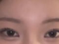 อิลมิริ + ผู้กำกับ โด ออน-รก + ศัลยกรรมทำตาสองชั้น + ศัลยกรรมเปลือกตาบน