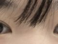 ฉันเข้ารับการผ่าตัดโดยผู้อำนวยการนา ยองซู ที่โรงพยาบาลอิลมิริ